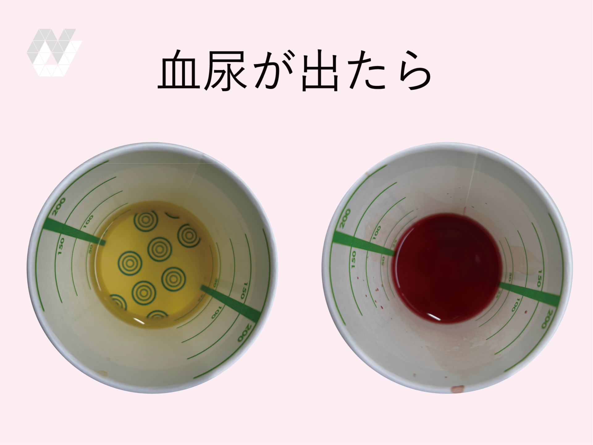 泌尿器科手術における血管外科 | 田邉 一成 |本 | 通販 | Amazon