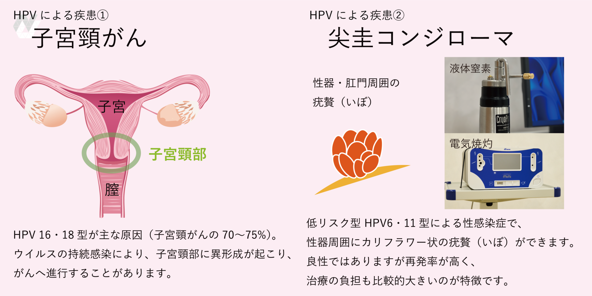 ヒトパピローマ ウイルス 感染 経路