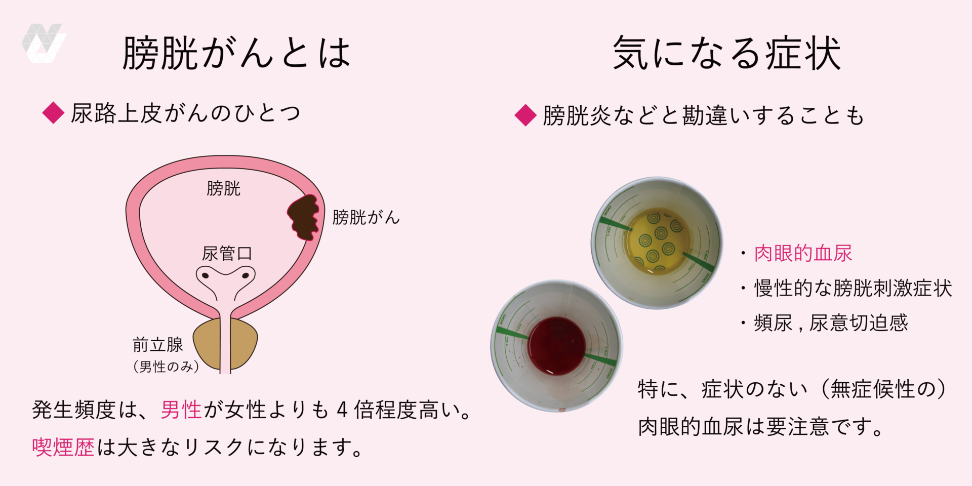 Urology View 6ー5 特集:知っておきたい泌尿器科領域における染色体異常，遺伝性疾 Urology View 6ー5 特集:知っておきたい泌尿器科領域における